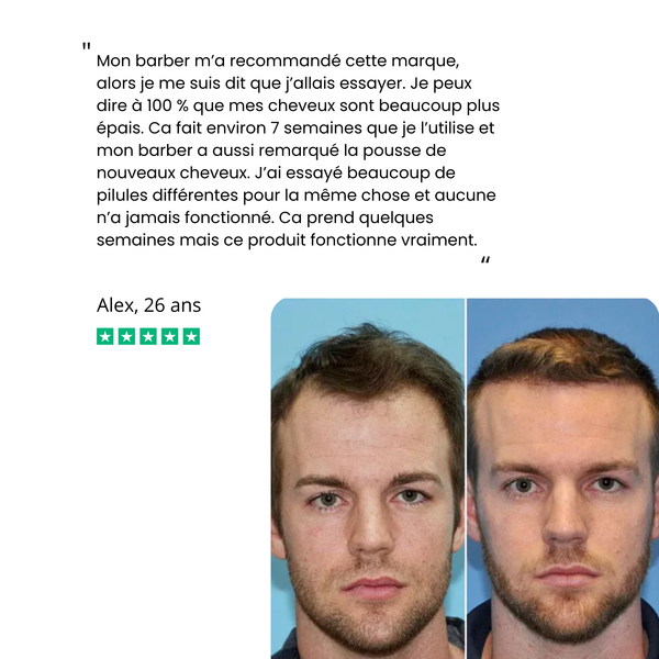 Sérum de croissance capillaire