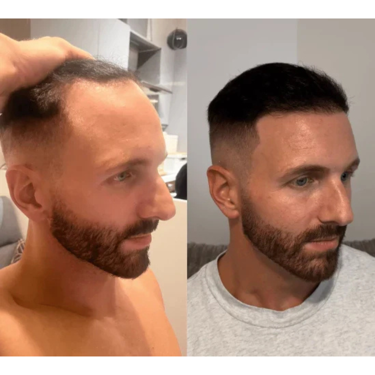 Sérum de croissance capillaire